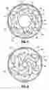 Fig. 06 - Gastric restrictor assembly and method of use
