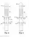 Fig. 03 - Anastomosis device approximating structure configurations