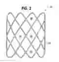 Fig. 03 - Anastomotic device