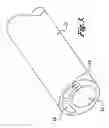 Fig. 04 - Double balloon thrombectomy catheter
