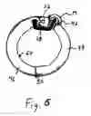 Fig. 05 - Tendon stripper