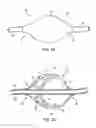 Fig. 03 - Apparatus and methods for clearing obstructions from surgical cutting instruments