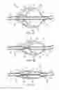 Fig. 04 - Apparatus and methods for clearing obstructions from surgical cutting instruments