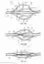 Fig. 05 - Apparatus and methods for clearing obstructions from surgical cutting instruments