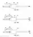 Fig. 14 - Apparatus and methods for clearing obstructions from surgical cutting instruments