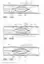 Fig. 33 - Exchange method for emboli containment