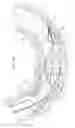 Fig. 04 - Hinged short cage for an embolic protection device
