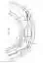 Fig. 06 - Hinged short cage for an embolic protection device