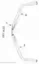Fig. 07 - Spinal rod inserter