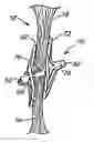 Fig. 01 - Catch member for PFO occluder