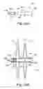 Fig. 06 - Catch member for PFO occluder