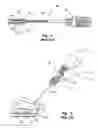 Fig. 02 - Tissue puncture closure system with retractable sheath