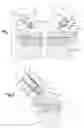 Fig. 02 - METHOD OF SECURING BODY TISSUE
