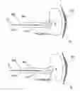 Fig. 05 - Methods and apparatus for monopolar renal neuromodulation