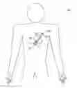 Fig. 01 - Modular antitachyarrhythmia therapy system