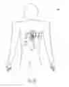 Fig. 06 - Modular antitachyarrhythmia therapy system