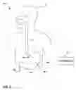 Fig. 02 - Intra-Luminal Device for Gastrointestinal Electrical Stimulation