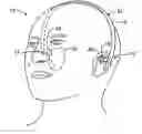 Fig. 01 - Headache reduction method and apparatus