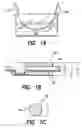 Fig. 02 - Construction of cylindrical multicontact electrode lead for neural stimulation and method of making same