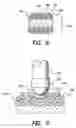 Fig. 06 - Construction of cylindrical multicontact electrode lead for neural stimulation and method of making same