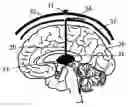 Fig. 01 - Probe device for electrical stimulation and recording of the activity of excitable cells