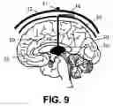 Fig. 06 - Probe device for electrical stimulation and recording of the activity of excitable cells