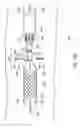 Fig. 28 - Method and apparatus for treating vulnerable plaque
