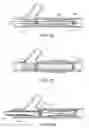 Fig. 11 - Methods and devices for protecting passageway in a body when advancing devices through the passageway