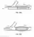 Fig. 13 - Methods and devices for protecting passageway in a body when advancing devices through the passageway