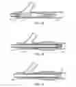 Fig. 15 - Methods and devices for protecting passageway in a body when advancing devices through the passageway