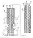 Fig. 02 - Stent delivery system with radially stabilized catheter