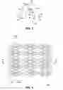 Fig. 03 - Polymeric stent patterns