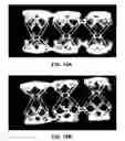 Fig. 09 - Polymeric stent patterns