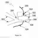 Fig. 04 - Stent and MR imaging process and device