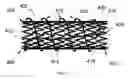 Fig. 05 - Stent and MR imaging process and device