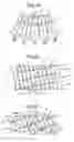 Fig. 13 - Deployable stent