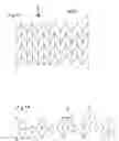 Fig. 20 - Deployable stent