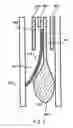 Fig. 06 - Prosthetic valve devices and methods of making and using such devices