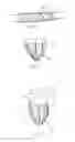 Fig. 09 - Filament Based Prosthesis