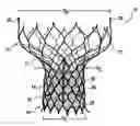 Fig. 01 - Heart valve prosthesis and methods of manufacture and use