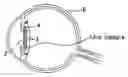 Fig. 01 - Intraocular lens