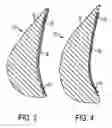 Fig. 03 - Breast prosthesis