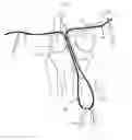 Fig. 01 - Apparatus and method for reconstructing a ligament