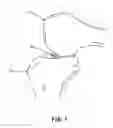 Fig. 02 - Apparatus and method for reconstructing a ligament