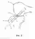 Fig. 03 - Apparatus and method for reconstructing a ligament