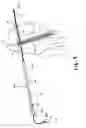 Fig. 10 - Apparatus and method for reconstructing a ligament