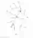 Fig. 04 - Apparatus and method for reconstructing a ligament