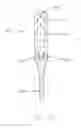 Fig. 12 - Apparatus and method for reconstructing a ligament