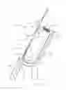 Fig. 29 - Apparatus and method for reconstructing a ligament