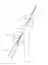 Fig. 41 - Apparatus and method for reconstructing a ligament